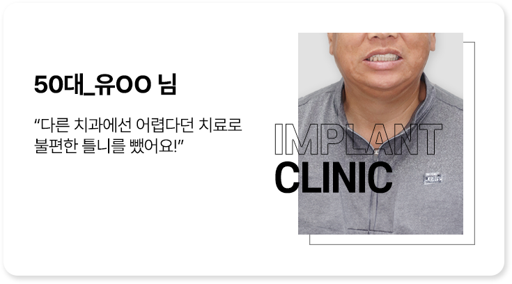 실제 임플란트 환자의 리얼후기 3